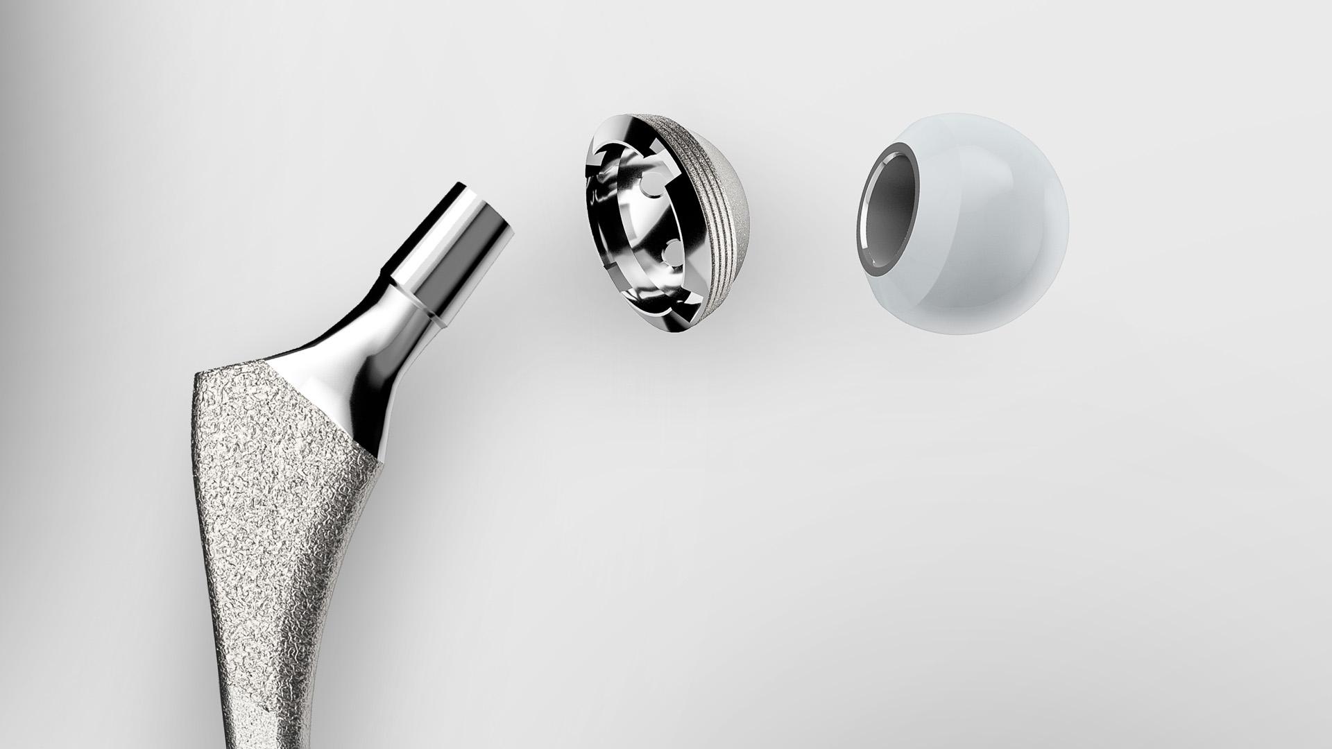 Khám phá các cổng chất lượng và giải pháp cho quy trình sản xuất implant chỉnh hình